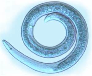 The round body of a microscopic nematode. Photo: University of Nebraska at Lincoln