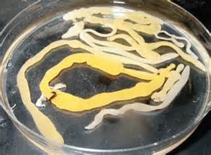 A tapeworm actually has a round head which posses hooks to attach to the lining of the gut. Photo: University of Nebraska Omaha