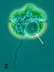 The dinoflagellate Karenia brevis. Photo: Smithsonian Marine Station-Ft. Pierce FL 