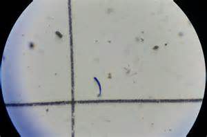 The most common form of microplastic are fibers. Photo: UF IFAS St. johns County